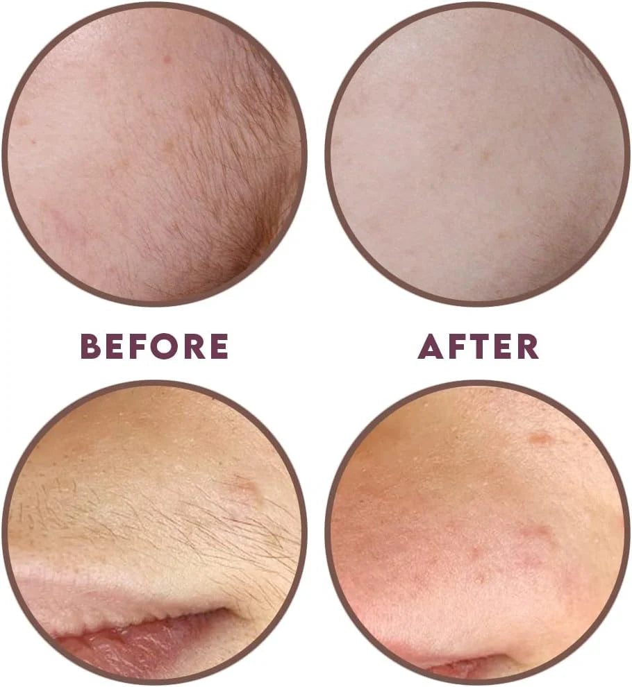 ThreadLux™ Hair Threading System – Smooth, Painless Face & Body Removal