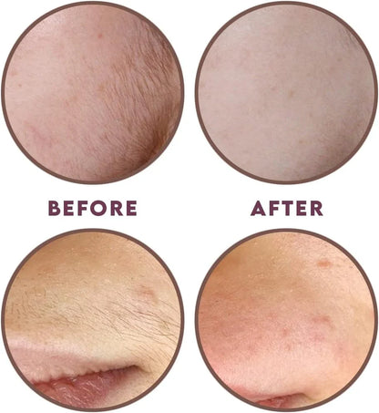 ThreadLux™ Hair Threading System – Smooth, Painless Face & Body Removal