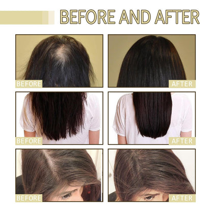 Thrive Locks™ - Hair Growth Oil 