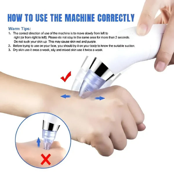 DERMA SUCTION | Pore Vacuum Cleaner