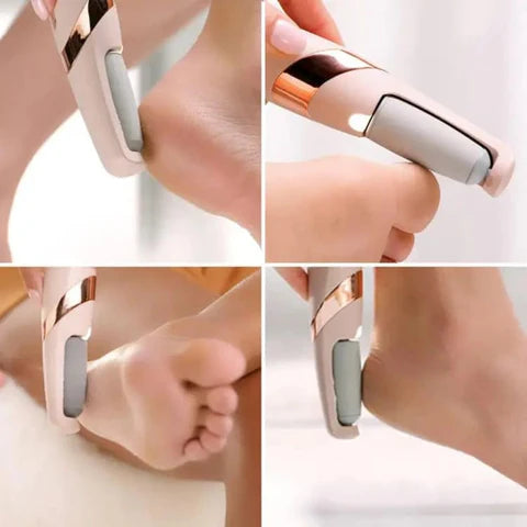 SmoothStep Pro™ Pedicure and Callus rechargeable Remover Tool